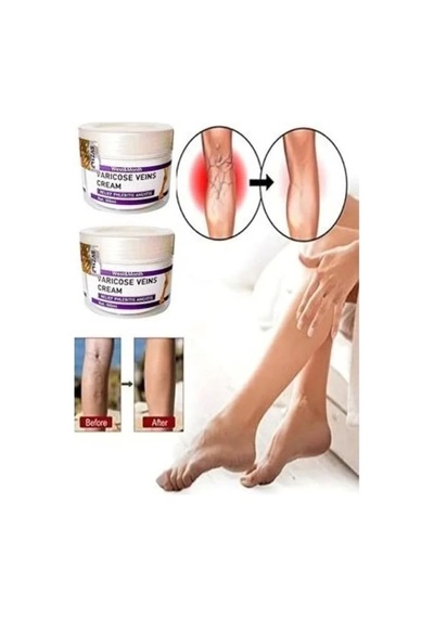 Süper V.ricose And Spider Vns Sthing Leg Cream Bacak Bakım Kremi 100 Ml X 2 Adet