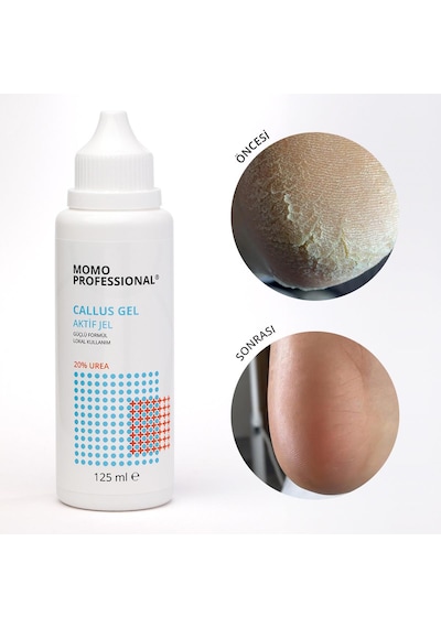Callus Gel, Nasır Sökücü Keratolitik Pedikür Jel, 125 Ml