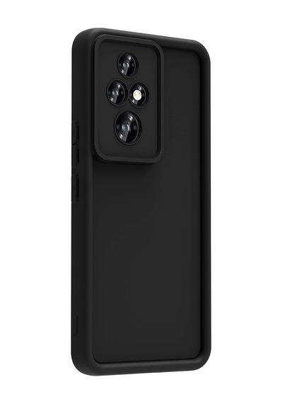 Zore Honor 200 Pro Kılıf Kamera Korumalı Omsy Ananas Kapak - Siyah