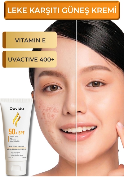 Devida UVA UVB Koruyucu Cilt Lekesi Önleyici Nemlendirici UvActive 400+ Yüz Güneş Kremi SPF50+ 50 ML