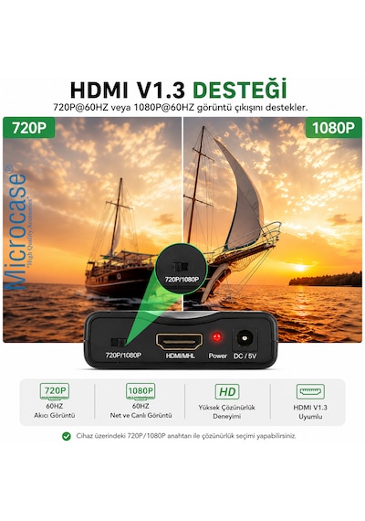 Microcase Scart To Hdmı Dönüştürücü 1080p Adaptör Güç Adaptörlü Hdmı Çevirici Al5746 Siyah