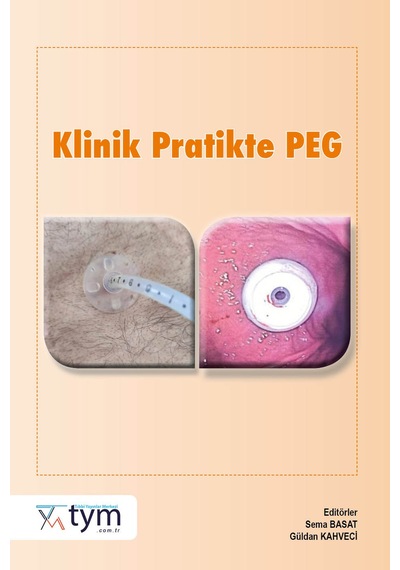 Klinik Pratikte Peg