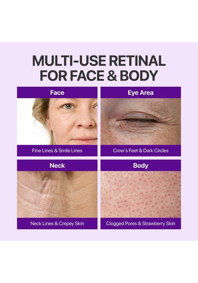 Tr No.9 Nad+ Retinal Volumetox Eye Cream, Anti-aging Treatment For Wrinkles, Fine Lines, Dark Circles & Dark Spots, Gent