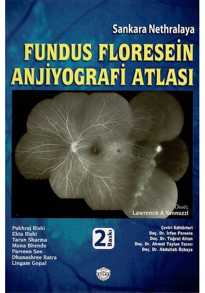 Fundus Floresein Anjiyografi Atlası