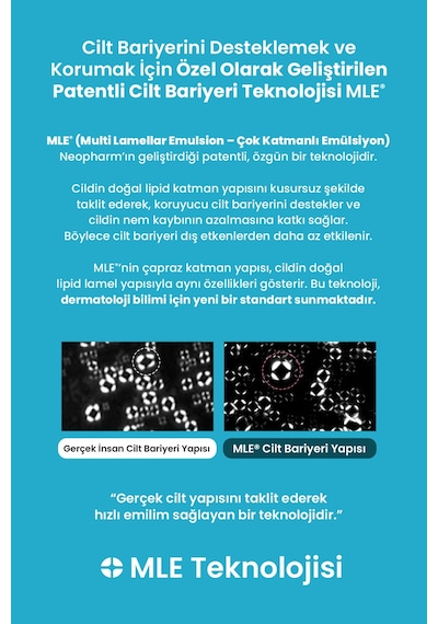 Kuru Ve Çatlamış Topuklar İçin, Peeling Etkili Nemlendirici Ayak Kremi Derma:b Urea Foot Cream
