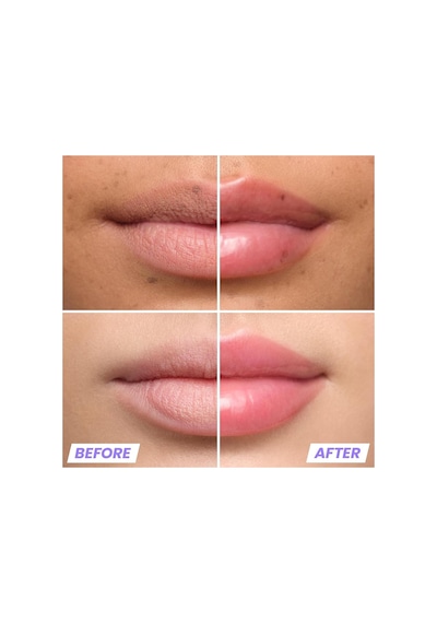 Wonderskin Lip Relapse Dolgunlaştırıcı Etki Şeffaf Dudak Parlatıcısı Clear 3.57ml Clear