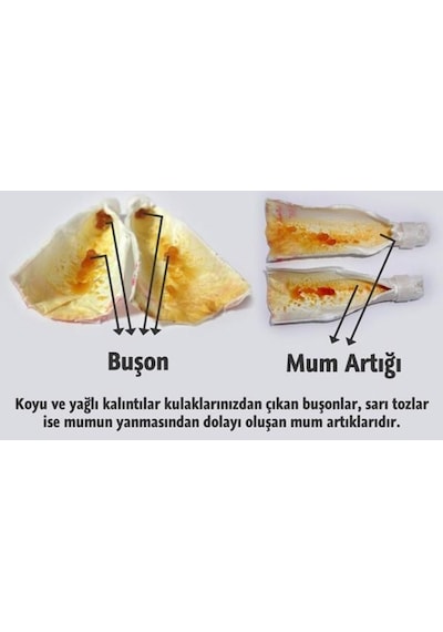 Vakumlu Ear Candle Doğal Kulak Temizleme Mumu Çubuğu x 5