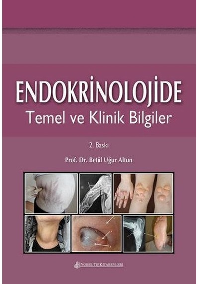 Endokrinolojide Temel Ve Klinik Bilgiler- Nobel Tıp Kitabevleri