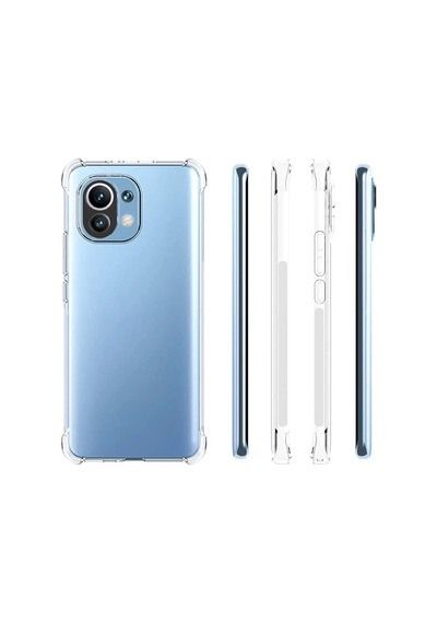 Hepsi Xiaomi Mi 11 Kamera Korumalı Shockproof Darbe Emici Silikon Kılıf- 5775 Najmaddin Şeffaf