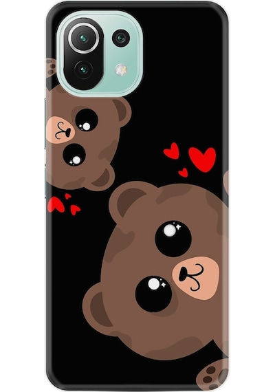 Xiaomi Mi 11 Lite Kılıf +Kablo Koruyucu Love Animals 1780