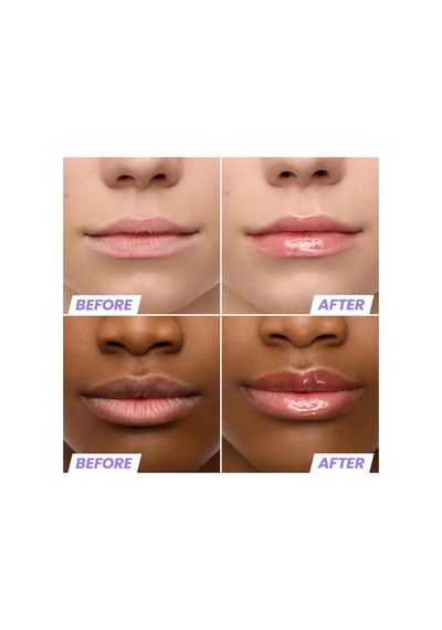 Wonderskin Lip Rehab Nemlendirici Ve Onarıcı Renkli Dudak Serumu Yağı Lover 3.57ml