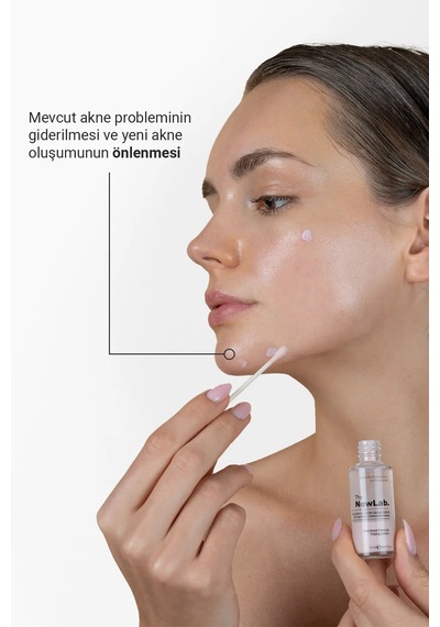 The NewLab Akne Karşıtı Losyon (2% Calamine 0.5% Salicylic Acid 3%tea Tree/chamomille/salix Alba Extract)