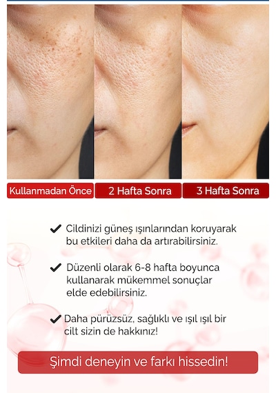 Retinol + Kolajen Serum 2 Li Set  Alın Çizgisi Göz Çevresi Ve Kaz Ayağı