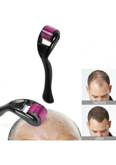 Mey İthalat Titanyum Derma Roller 1.00 Mm