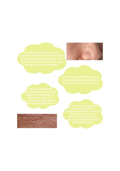 Skin Care Toner - Yağlı Ciltler İçin Cilt Bakım Suyu