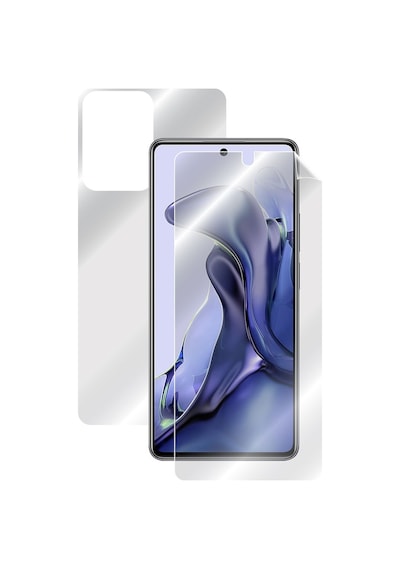 Ipg Xiaomi 11T - Mi 11T Tam Kaplama (Ekran Ve Arka Koruma)