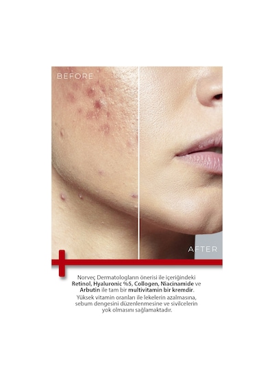 Todays Clinicals Retinol Shea Butter Onarıcı Nemlendirici Krem 100 ML