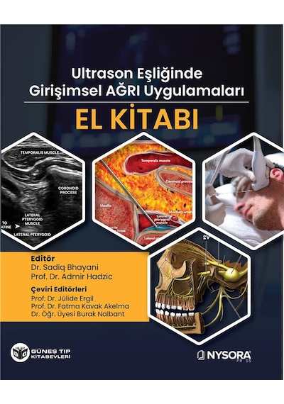 Nysora - Ultrasn Eşliğinde Girişimsel Ağrı Uygulamaları El Kitabı Video Destekli