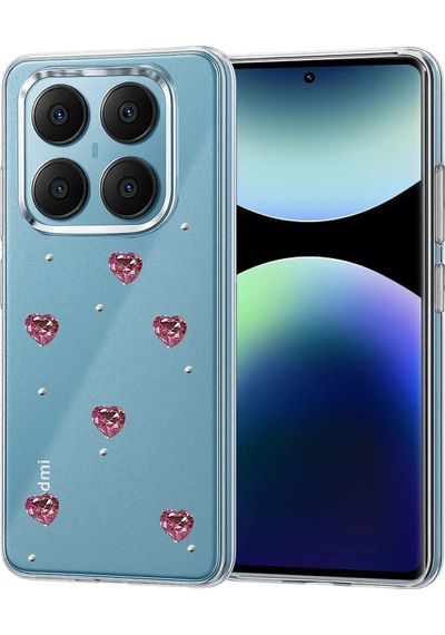 Durukar Redmi Note 14 Pro 4g Fiyonk Desenli Kapak - Desen 7