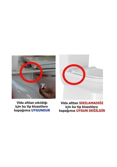 Ege Anatolia Klozet Kapağı Akdeniz Klozet Kapak Antibakteriyel Hijyenik Lüx Alttan Sıkmalı Diğer