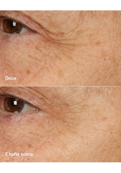 Kırışıklıkları Ve Çizgileri Smart Clinical Repair Onarmaya Yardımcı Gece Bakım Kremi Maskesi 50ml