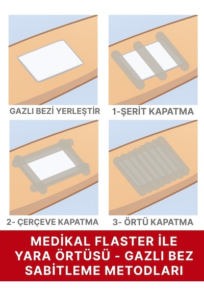 Bez Flaster 2,5 Cm X 5 M Pamuklu Medikal Sabitleme Bandı Tekli Rulo