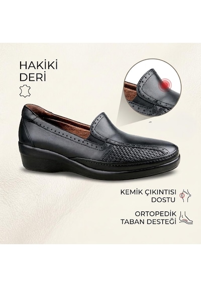 Ceyo 9920-32 Kadın Hakiki Deri Kemik Çıkıntısı Destekli Günlük Ayakkabı Siyah