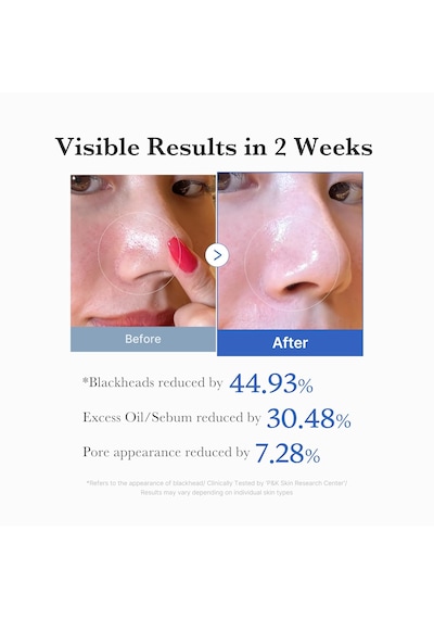 Medıcube Zero Pore Pad 2.0 Aha Bha Gözenek Ve Siyah Nokta Karşıtı Tonik Ped 70 Adet Kbeautyflashsale