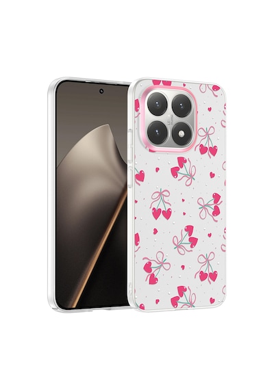 Xiaomi 15t Kılıf Çiçek Ve Fiyonk Desenli Kamera Yükseltili Celikaksesuar Premium Diğer