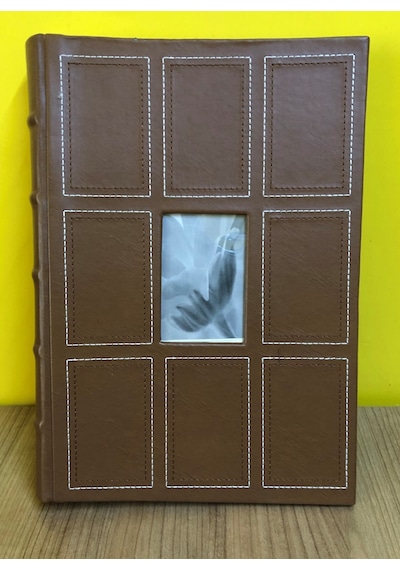 Aledo 10x15cm 300 Lük Deri Özel Lüx Fotoğraf Albümü-l1300 Kahve