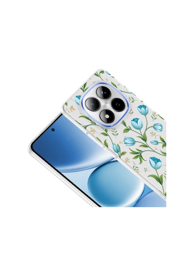 Redmi Note 15 Pro 4g Kılıf Kamera Korumalı Desenli Zore Klip Kapak - Mavi Lale -