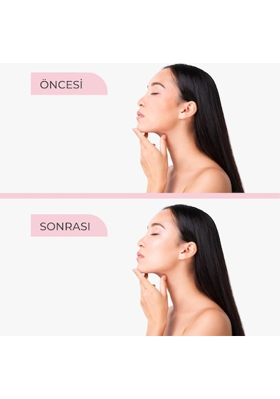Doğal Gül Suyu Sprey, Yüz İçin Nemlendirici Tonik, Gözenek Sıkılaştırıcı, Arındırıcı Ve Ferahlatıcı, T