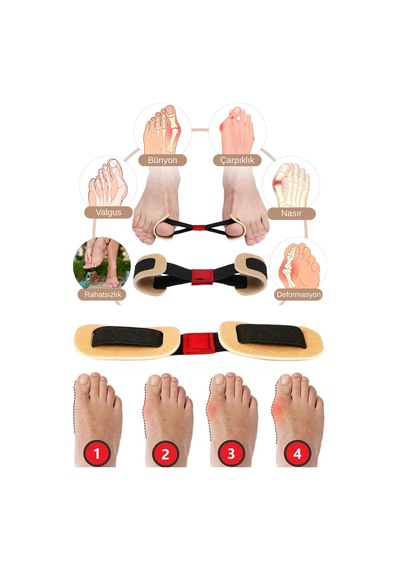 Ayak Baş Parmak Egzersiz Lastiği Hallux Valgus Bunyon Düzeltici Güçlendirici Aparat - 850294370
