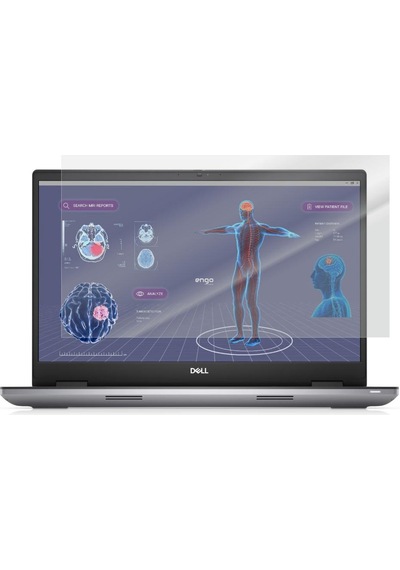 Dell Precision 7780 17.3 İnç Mat Ekran Koruyucu Şeffaf
