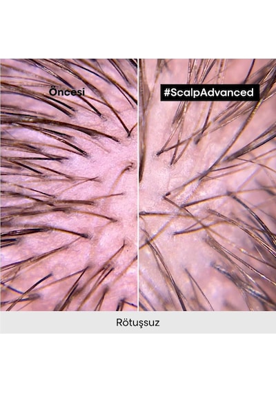 L'Oréal Professionnel Scalp Advanced Hassas Saç Derisi İçin Şampuan Refill 500 ML