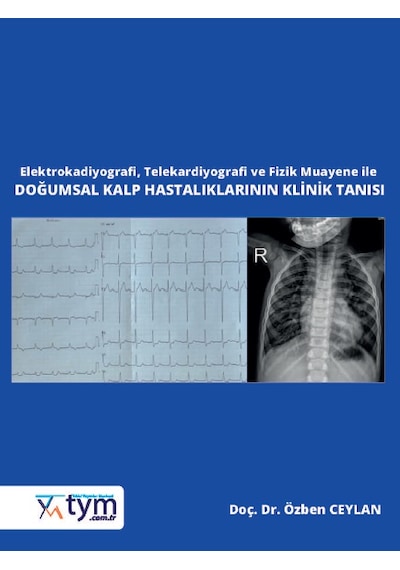 Elektrokardiyografi, Telekardiyografi Ve Fizik Muayene İle Doğums