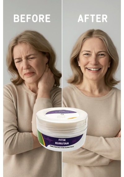 Süper Fıtık Kurutan Krem 50 Ml