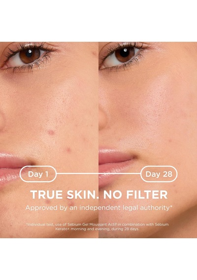 Bioderma Sébium Kerato Sivilce Ve Akne Lekesi Karşıtı Aha, Bha, Salisilik Asit İçeren Bakım Kremi 30 Ml