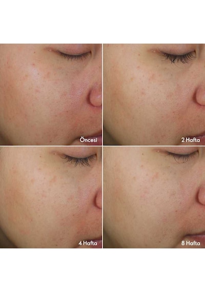 Oriflame Novage+ Daha Aydınlık Ve Genç Görünen Bir Cilt Sunan Karma Bright Intense Cilt Bakım Seti
