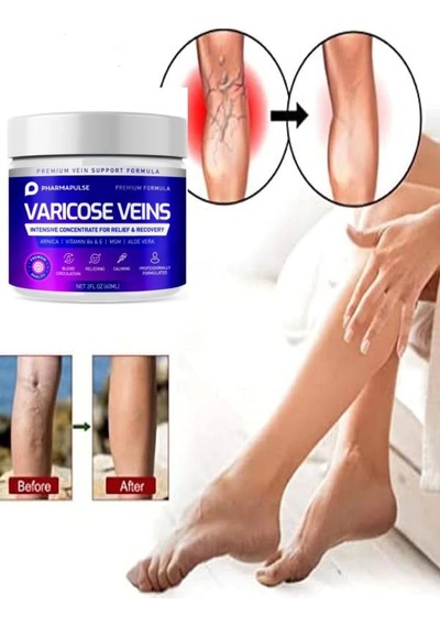 Maximum Strength Varicose Vein Var.is 100 Ml X 2 Adet