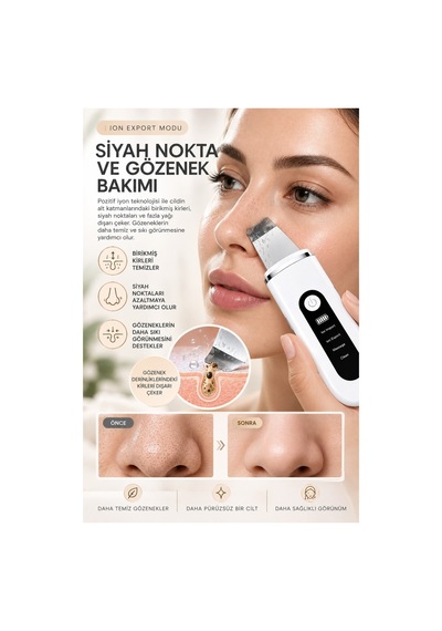 Robeve Auhma Ahb-13 Ultrasonik Cilt Temizleme Ve Yüz Bakım Cihazı 4 Modlu Iyon Teknolojili Cilt Spatulası, Siyah Nokta Ve Gözenek Temizleyici, Masaj Modu, Yüz Masaj Aleti Spatula Yüz Temizleme