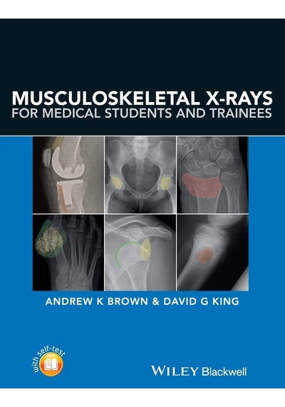 Musculoskeletal X-rays For Medical Students And Trainees