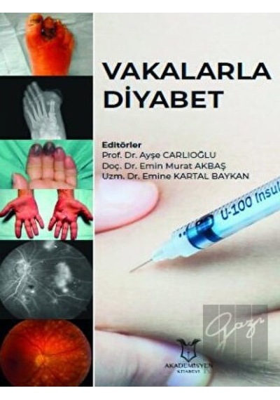 Vakalarla Diyabet - Akademisyen Kitabevi - Tıp Kitapları
