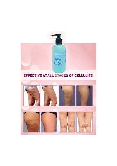 Northcity Lipo Cold Sıkılığa Inceliğe Hafifliğe Ve Selülilitlerinize Güçlü Etkide Krem 250 Ml X 2 Adet