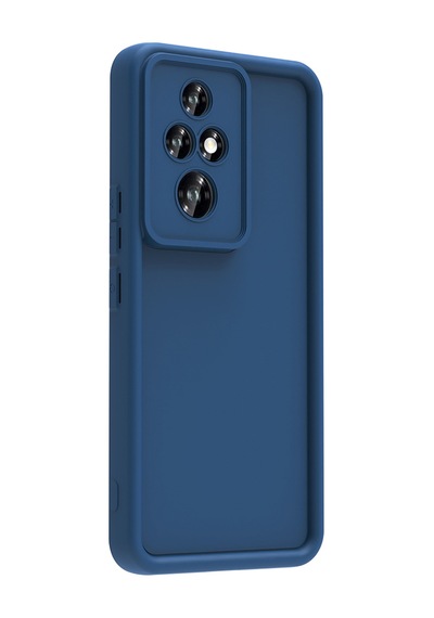 Zore Honor 200 Pro Kılıf Kamera Korumalı Omsy Ananas Kapak - Siyah