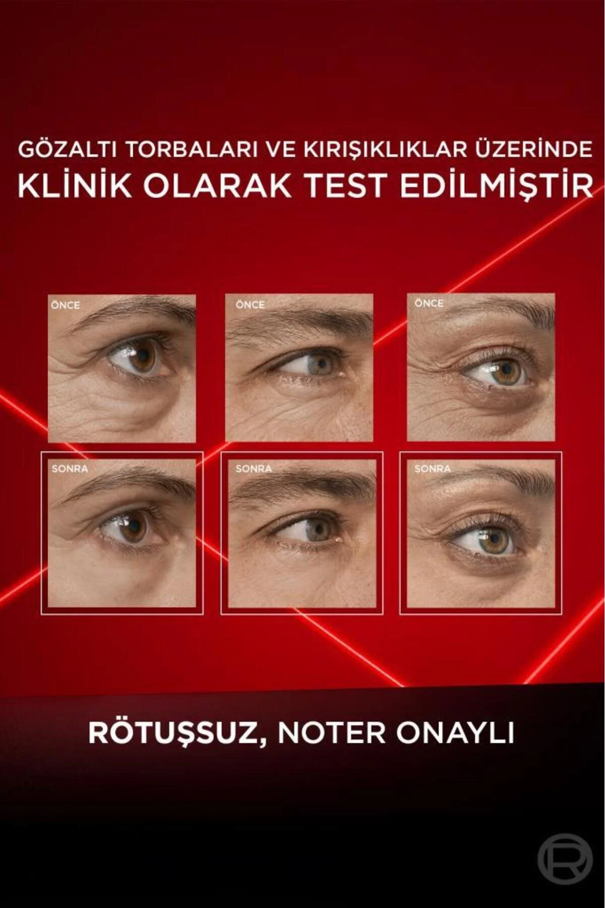 L'Oréal Paris Revitalift Lazer Eyebag Instant Eraser Göz Altı Torba Görünümüne Karşı Etkili Göz Kremi 15 ML