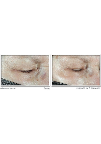 Roc Multi Correxion Hydrate Plump Göz Çevresi Kremi 15ml
