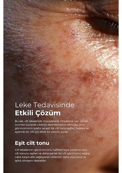 Tto Aplikatörlü Yüz Temizleme Köpüğü 200 ML + Dermodicos Plus Krem 30 ML