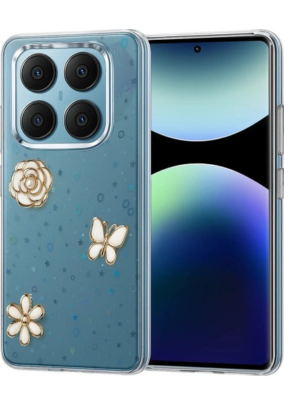 Durukar Redmi Note 14 Pro 4g Fiyonk Desenli Kapak - Desen 10
