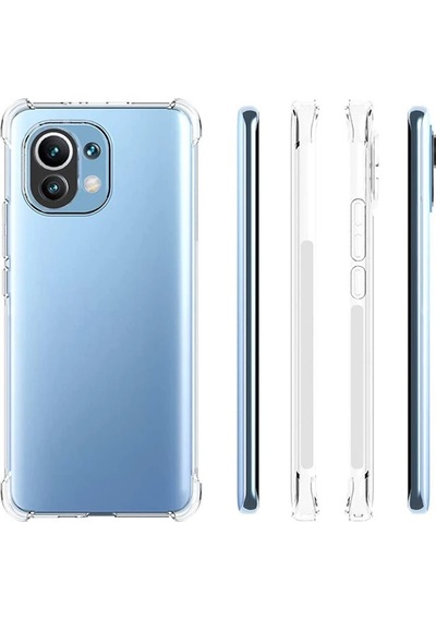 Xiaomi Mi 11 Kamera Korumalı Shockproof Darbe Emici Silikon Kılıf- 5775